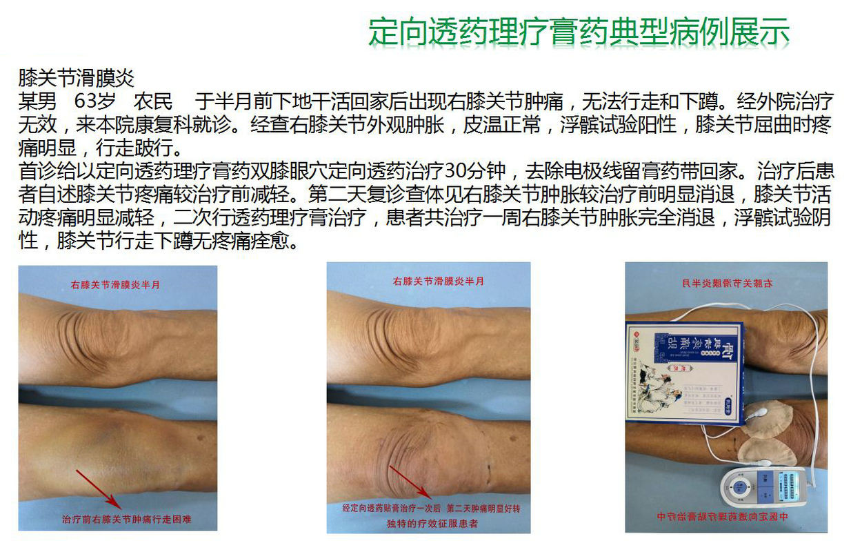 疼痛贴9.jpg